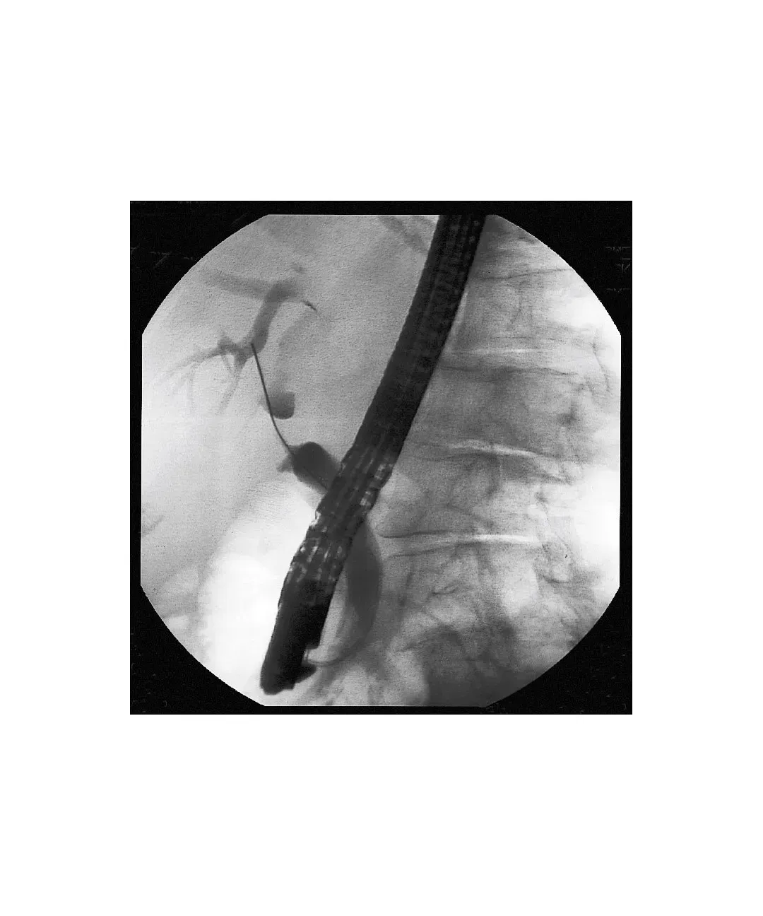 Non Vascular Sterile Hydro Slide Guidewires