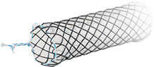 Airway Stents