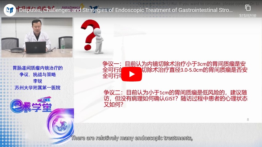 Disputes, Challenges And Strategies Of Endoscopic Treatment Of Gastrointestinal Stromal Tumors